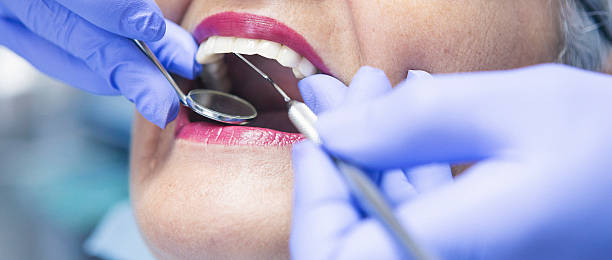 Best Same-Day Emergency Dental Services in Seyur, MO